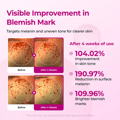 LUHAKA®  Poren & Pickelpflege Duo